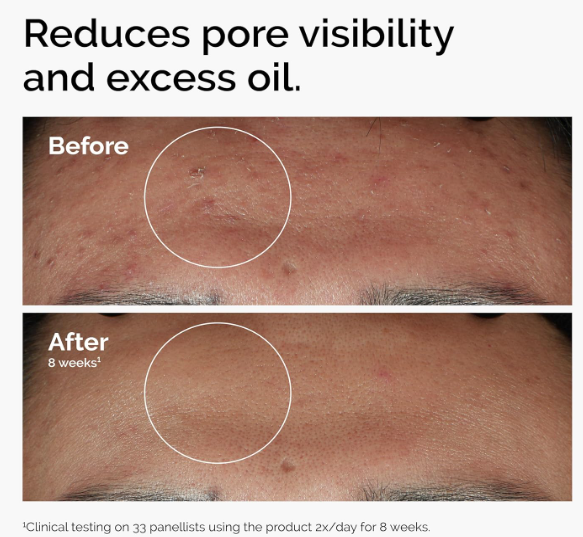 best tips for healthy skin